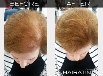 Hairatin-beautiful-hair