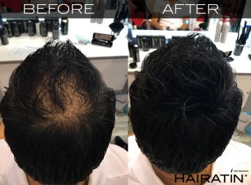 Hair concealer