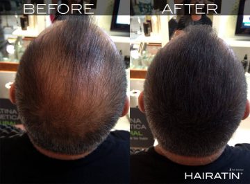 Hairatin-beautiful-hair