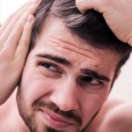 Man going bald