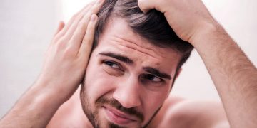 Man going bald