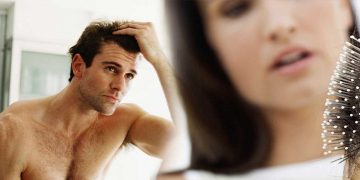 Lossing hair in your 20's