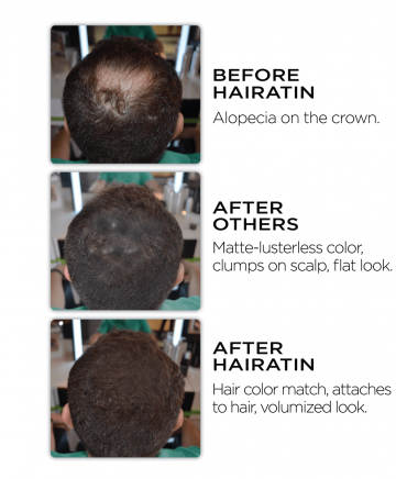 Befor After Hairatin