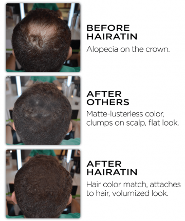 Before after Hairatin