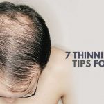 THINNING MAN