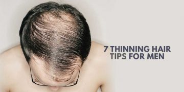 THINNING MAN
